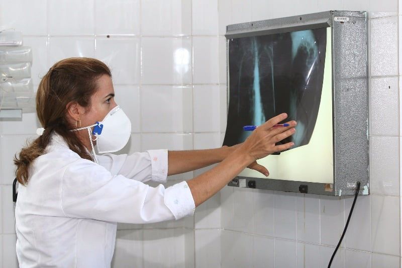 Tuberculose teste