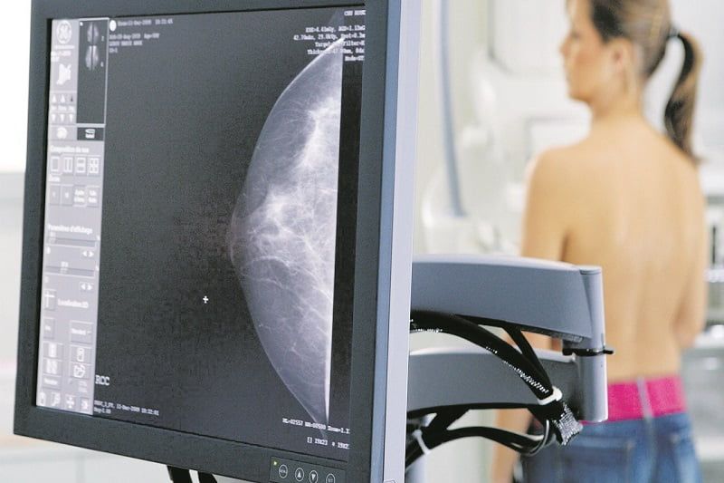 Na contramão do país, Barueri aumenta cobertura nos exames de mamografia