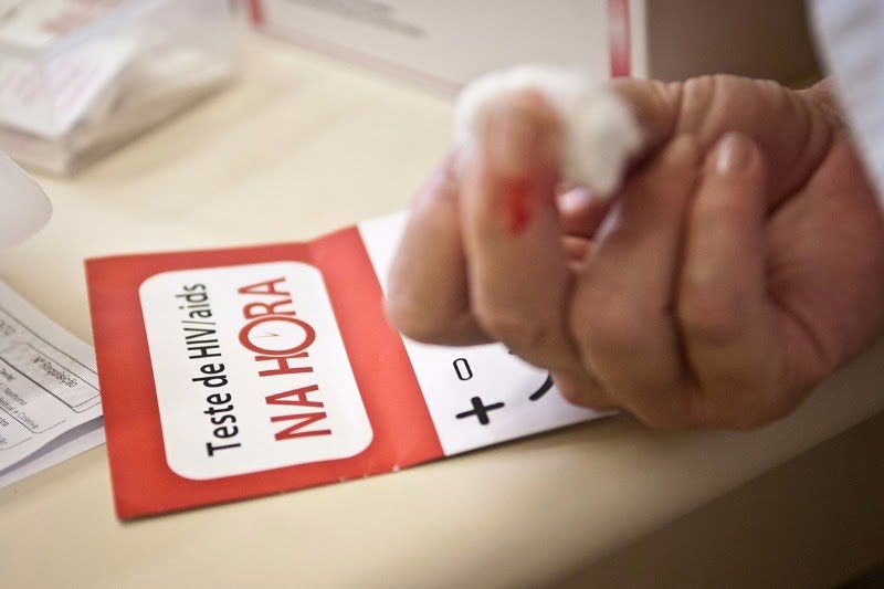 HIV